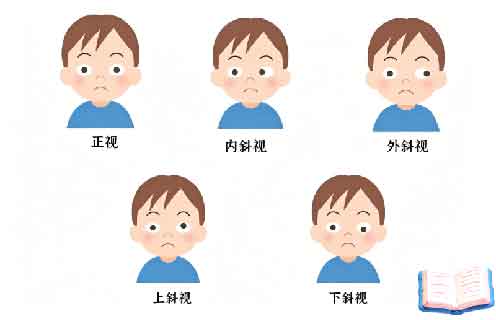 为什么孩子会弱视？这4个原因最常见，家长一定要警惕